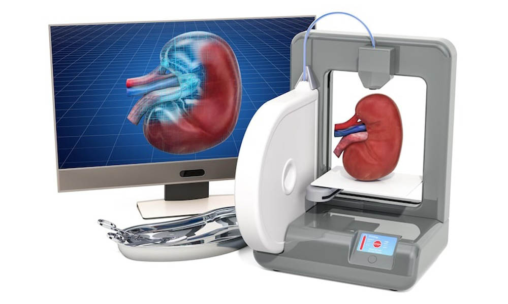 benefits-of-robotic-urology-surgery
