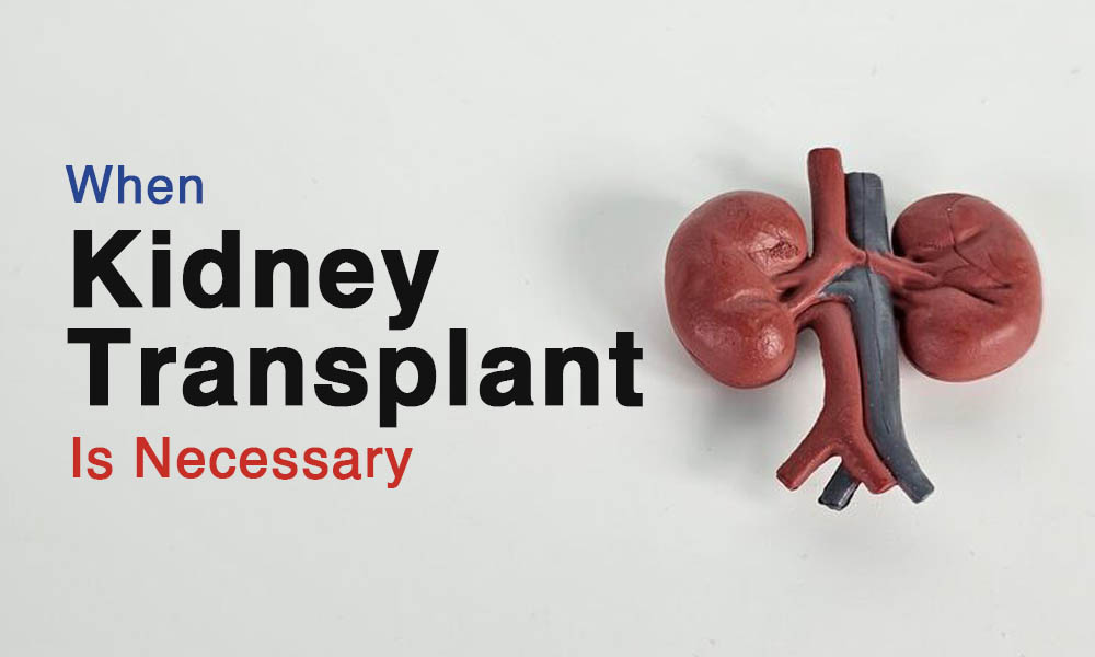 when-is-kidney-transplant-is-necessary